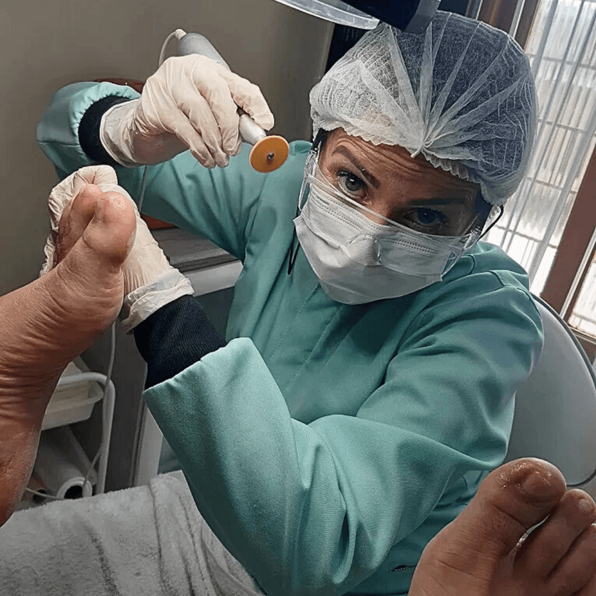 Podóloga paramentada realizando procedimento seguro nos pés