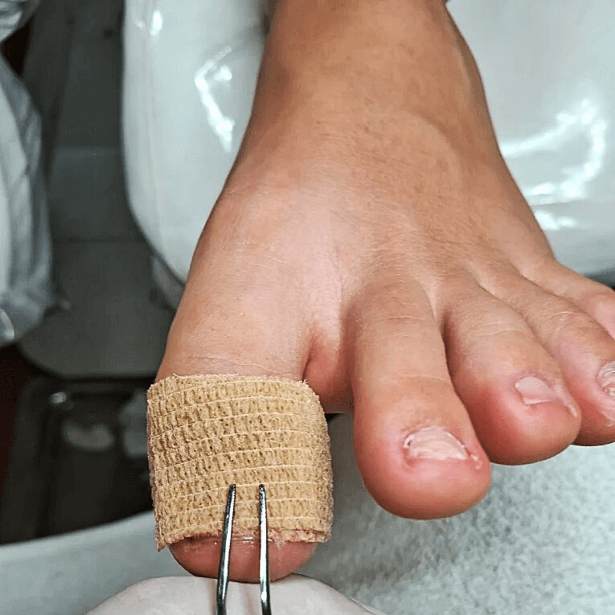Dedo do pé com curativo especial pós-procedimento de unha encravada