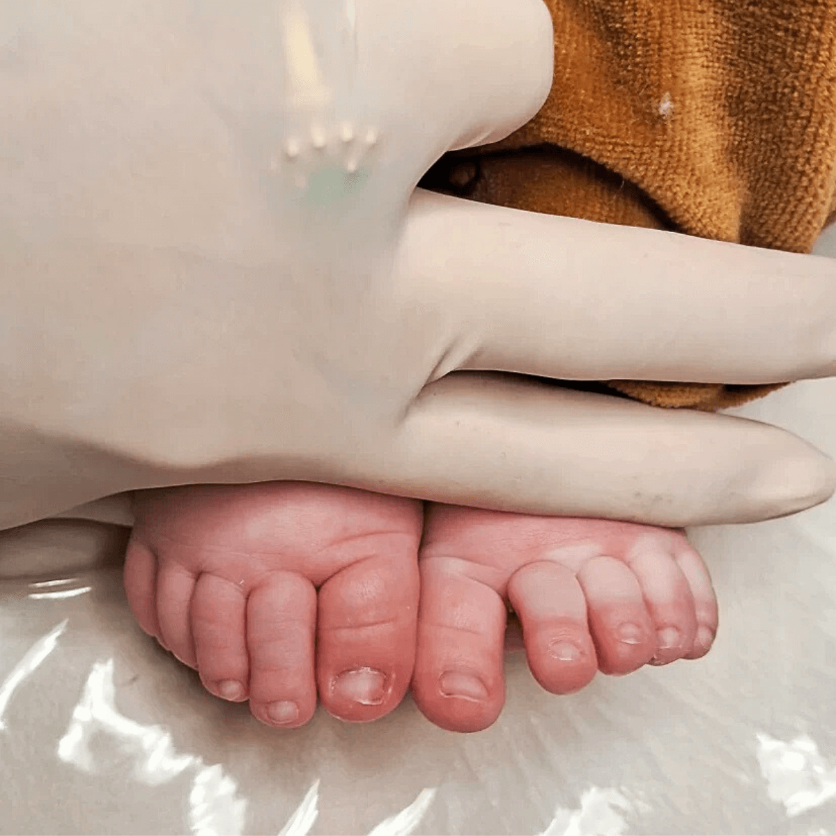 Pezinho de bebê saudável após avaliação podológica preventiva